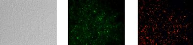 Gleiche mikroskopische Aufnahme nach der Analyse mit dem Testkit: Phasenkontrast, alle lebenden Zellen leuchten grün und Tepidimonas spezifisch rot.