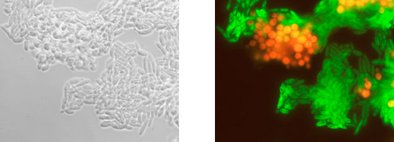 Identical microscopic image: phase contrast (left), bligate fermentative yeasts shine red, potentially fermentative yeasts green (right) after analysis with gene probe technology. 