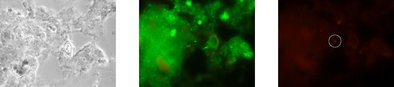 Identische mikroskopaufnahme vor und nach der Analyse mittels Gensondentechnologie: Phasenkontrast (links), alle lebenden Bakterien leuchten grün (mitte), C. perfringens leuchtet spezifisch rot (rechts).