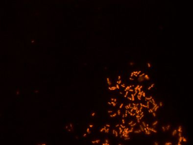 Analyse mit VIT®: lebenden, unkultivierbaren, flockenbildenden Bakterien leuchten rot