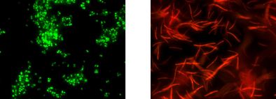 Gleiche mikroskopische Aufnahme nach der Analyse mit dem Testkit: Methanogene Bakterien leuchten spezifisch rot oder grün.
