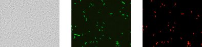 Gleiche mikroskopische Aufnahme nach der Analyse mit dem Testkit: Phasenkontrast, alle lebenden Zellen leuchten rot und Pseudomonas aeruginosa spezifisch grün.