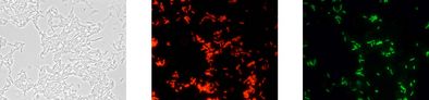 Identische Mikroskopaufnahme: Phasenkontrast (links), nach Analyse mittels Gensondentechnologie leuchten alle coliformen Zellen rot (mitte) und E. coli spezifisch grün (rechts).