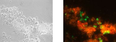 Identical microscopic image after VIT® analysis: phase contrast, nitrite oxidizing bacteria shine green, ammonia oxidizing bacteria red.
