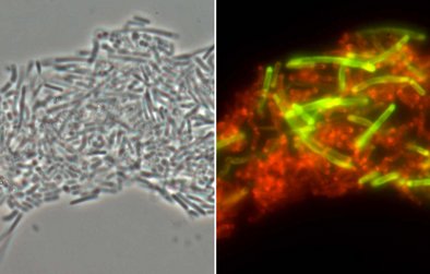 Identical microscopic image: phase contrast (left), all living beer-spoiling lactic acid bacteria shining red (center) and Lactobacillus brevis shining specifically green (right) after analysis with gene probe technology.