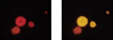 Gleiche mikroskopische Aufnahme nach der Analyse mit dem Testkit: gewachsene Mikrokolonien von coliformen Bakterien leuchten rot, E.coli spezifisch gelblich-orange.