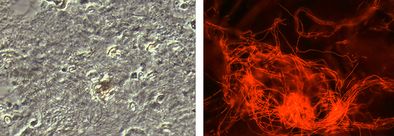 Identische Mikroskopaufnahme: Phasenkontrast (links), Microthrix parvicella leuchtet spezifisch rot nach Analyse mittels Gensondentechnologie (rechts). 