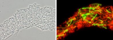 Gleiche mikroskopische Aufnahme nach der Analyse mit dem Testkit: Phasenkontrast, lebende bierschädliche Milchsäurebakterien leuchten rot, Lactobacillus brevis spezifisch grün.