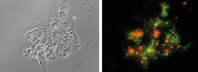 Identische mikroskopaufnahme: Phasenkontrast (links), nach Analyse mittels Gensondentechnologie leuchten alle lebenden Bakterien grün und Anammox-Bakterien spezifisch rot. 