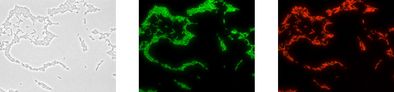Gleiche mikroskopische Aufnahme nach der Analyse mit dem Testkit: Phasenkontrast, Legionella spp. leuchtet grün und Legionella pneumophila spezifisch rot.