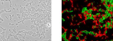 Gleiche mikroskopische Aufnahme nach der Analyse mit dem Testkit: Phasenkontrast, Megasphaera cerevisiae leuchtet grün und Pectinatus spp. rot.
