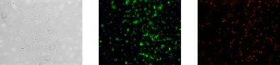 Gleiche mikroskopische Aufnahme nach der Analyse mit dem Testkit: Phasenkontrast, alle lebenden Zellen leuchten grün, Cloacibacterium spezifisch rot.