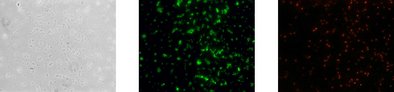 Gleiche mikroskopische Aufnahme nach der Analyse mit dem Testkit: Phasenkontrast, alle lebenden Zellen leuchten grün und Cloacibacterium spezifisch rot.