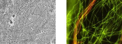 Identical microscopic image after analysis with the test kit: phase contrast, Chloroflexi filaments shine in green, Eikelboom Type 1851 shines in red.