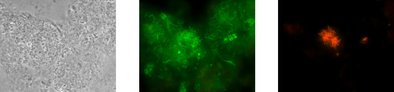 Gleiche mikroskopische Aufnahme nach der Analyse mit dem Testkit: Phasenkontrast, alle lebenden Bakterien leuchten grün, Nocardia leuchten spezifisch rot.