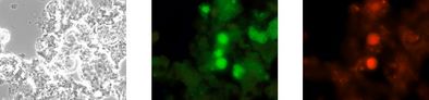 Gleiche mikroskopische Aufnahme nach der Analyse mit VIT®: Phasenkontrast, alle lebenden Bakterien leuchten grün und Anammox-Bakterien spezifisch rot.