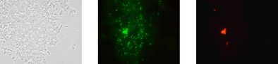 Gleiche mikroskopische Aufnahme nach der Analyse mit dem Testkit: Phasenkontrast, Staphylococcus spp. leuchtet grün und Staphylococcus aureus spezifisch rot.