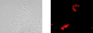 Gleiche mikroskopische Aufnahme nach der Analyse mit dem Testkit: Phasenkontrast, Campylobacter spp. leuchtet spezifisch rot.