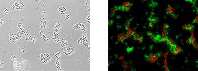 Identical microscopic image: phase contrast (left), bacteria of the genus Alicyclobacillus shine green and yeasts red (right) after analysis with gene probe technology.
